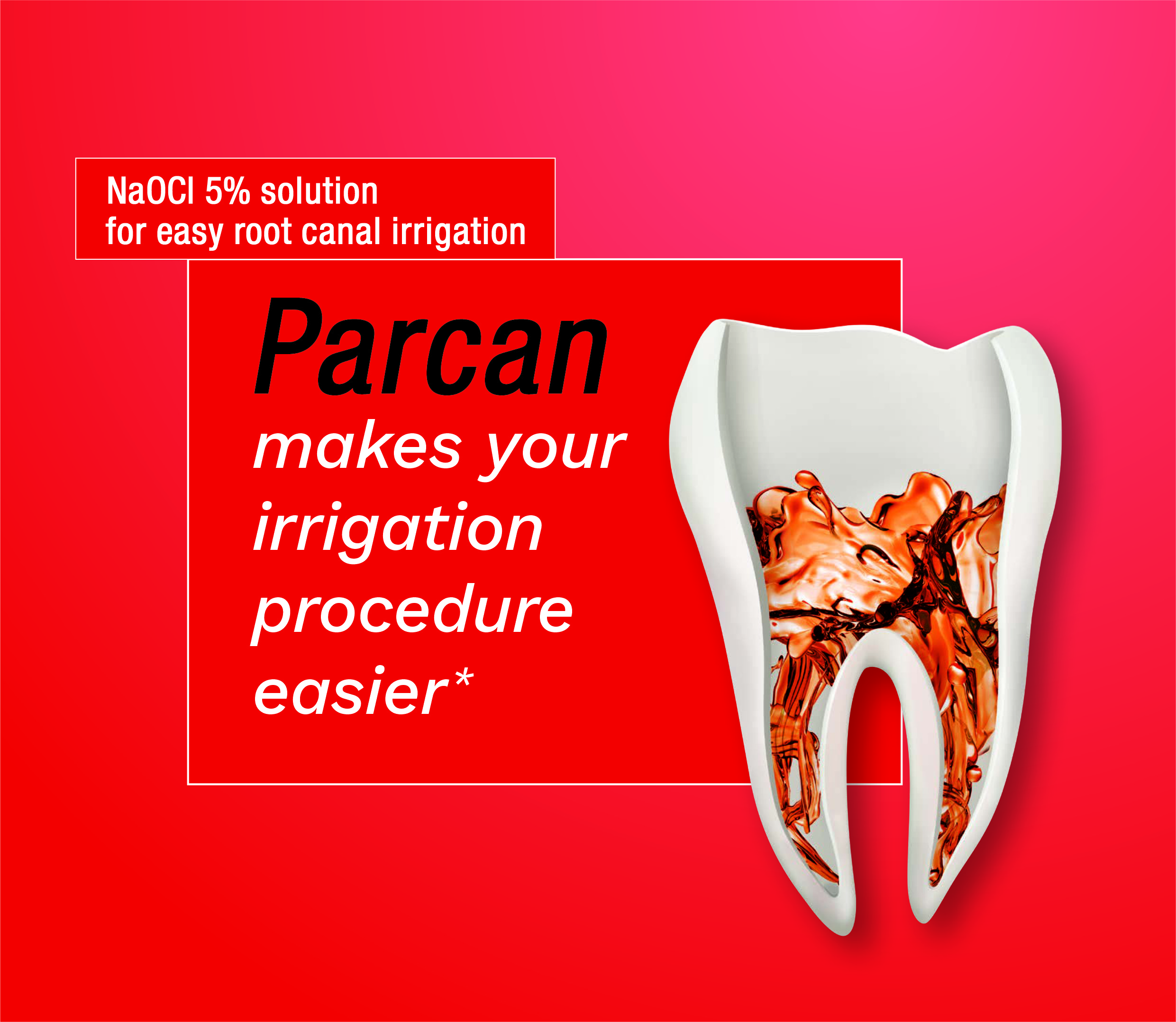 Sodium hypochlorite root canal irrigation