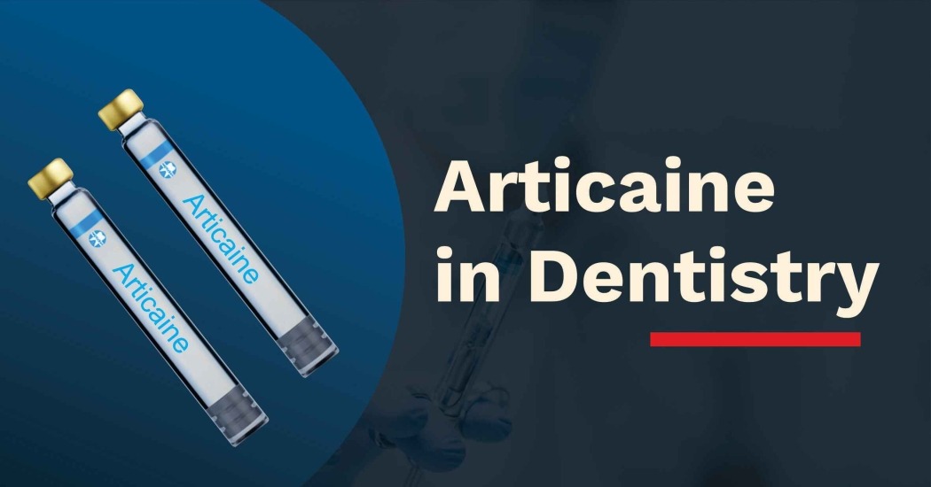 Articaine injection in dentistry